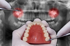 odontologia-restauradora