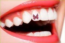 adornos-dentales-3