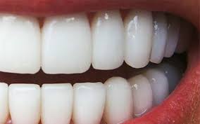 rehabilitacion-zirconio-dental-1