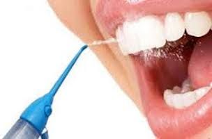 Beneficios del uso de los irrigadores dentales